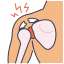 Joint Dislocations and Instability Injuries